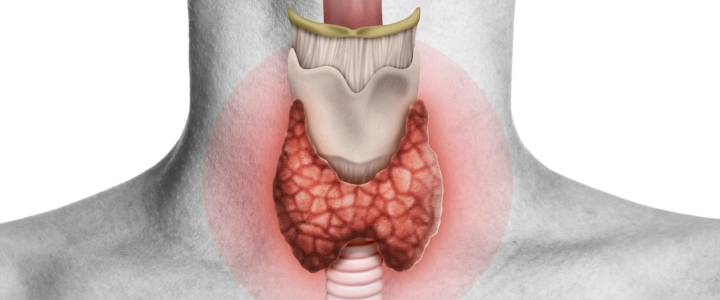 Hipotireoidismo (Baixa atividade da tireóide)
